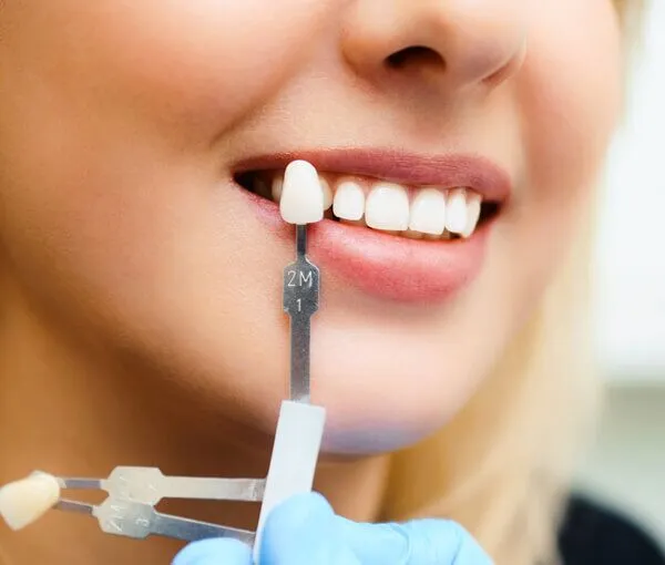 How Will I Know When It’s Safe to Repeat Whitening Dunstable
