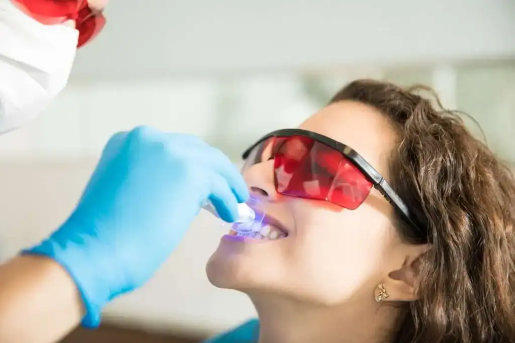 Laser Teeth Whitening FAQs Dunstable &ndash; Your Ultimate Guide Dunstable