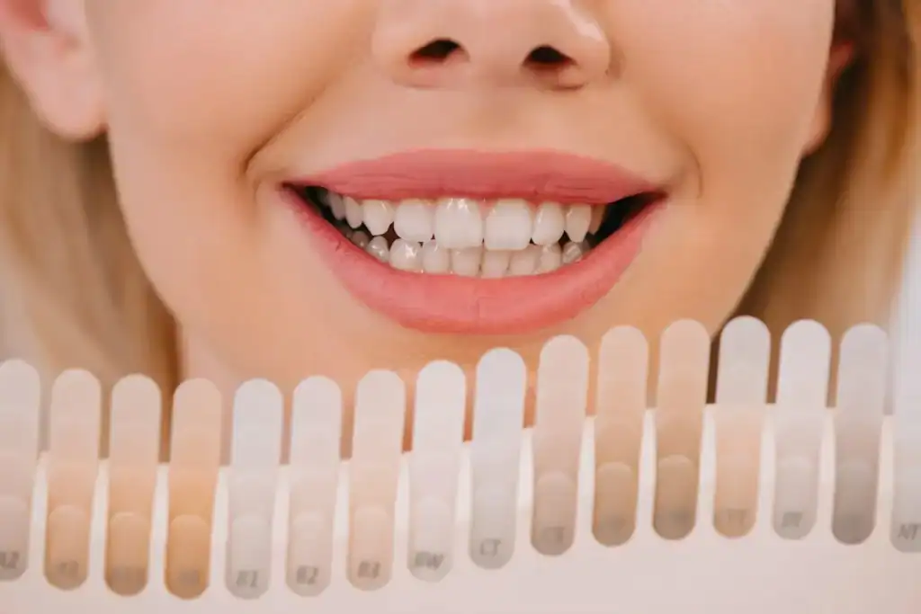 How Can I Maintain My Whitening Results Between Sessions Dunstable